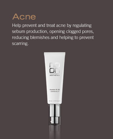 Acne products Noon